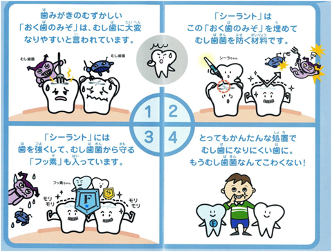 シーラントって?